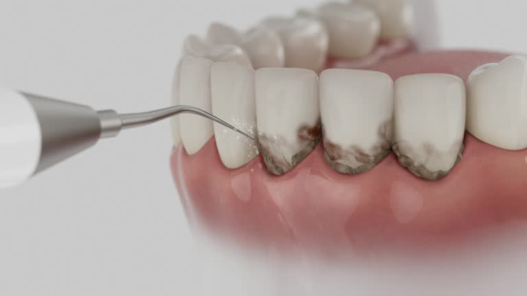 Trusted Tooth Extraction service in Mobridge, SD - Dentist Open Now